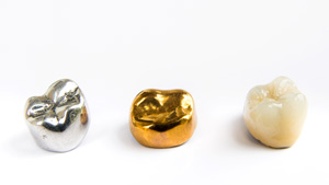 The materials used to make your dental crown will affect the cost of your restoration
