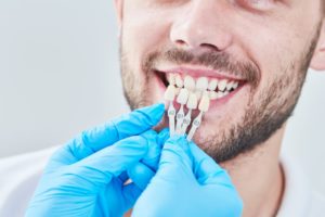man being fitted for porcelain veneers by his cosmetic dentist in M5R 3K4